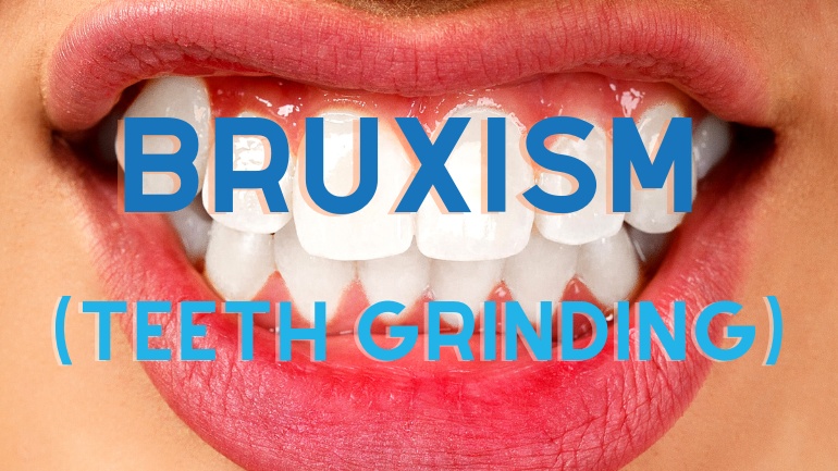 Bruxism (Teeth Grinding): A Growing Concern