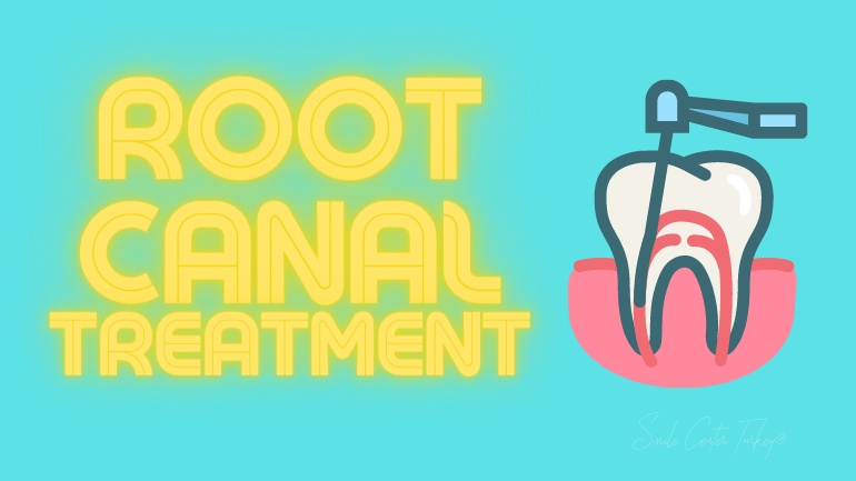 How to Understand Failed Canal Treatment