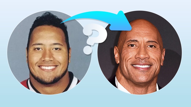 The Rock with Hair: Will Dwayne Johnson Ever Get His Hair Back?