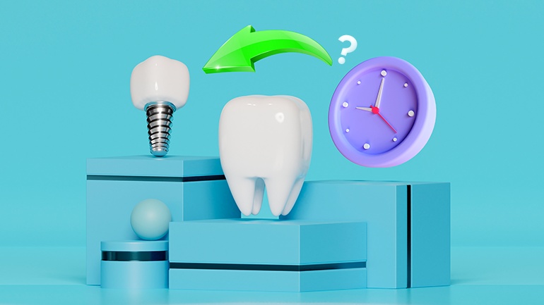 When Is Implant Made in Place of The Extracted Teeth? | Smile Center